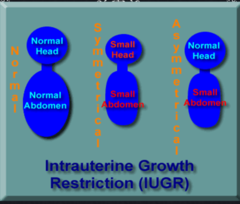 <p>Intrauterine growth restriction</p>