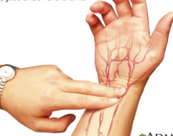 <p>is on the wrist, extending from the artery from the thumb</p>