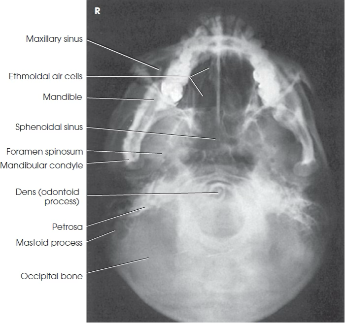 <p>What view is this?</p>