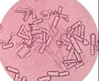 <p>Struvite Crystals</p>