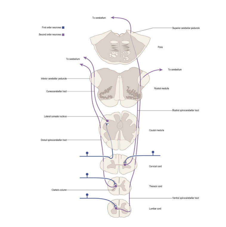 <p><strong>• Location:</strong> Dorsal &amp; ventral tracts run in the lateral column of the spinal cord</p><p></p><p><strong>• Function:</strong> Carry proprioceptive signals from the limbs and trunk to the cerebellum</p><p><strong>• Pathway: only 2 neurons</strong></p><p>• 1st order: proprioceptors (muscles, joints, tendons) → dorsal horn of the SC</p><p>• 2nd order : dorsal horn of the SC → cerebellum</p><p></p><p><strong>• Dorsal SCT</strong> - stays ipsilateral, enters cerebellum via inferior cerebellar peduncle</p><p><strong>• Ventral SCT </strong>- crosses in spinal cord, ascends contralaterally, then crosses back in cerebellum, enters cerebellum via superior cerebellar peduncle</p><p></p><p>• As the ventral SCT crosses twice, both tracts give ipsilateral cerebellar feedback</p><p></p>