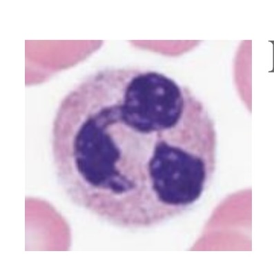 <p>What WBC is this? </p>