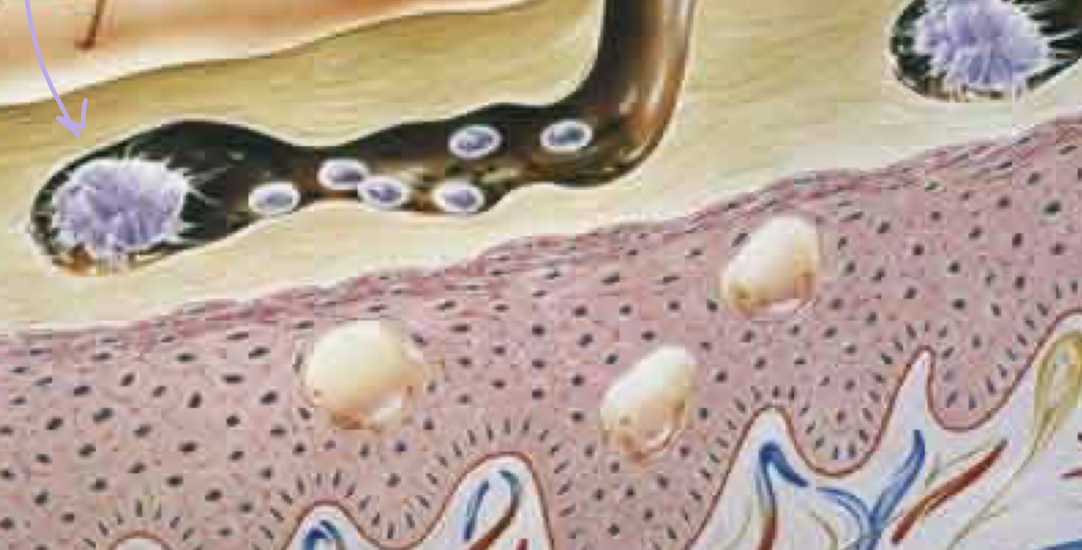<p>What ectoparasite is this?</p>
