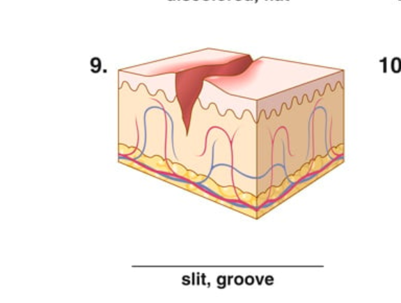 <p>slit, groove</p>