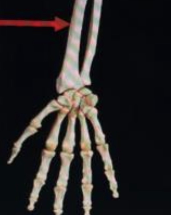 term image