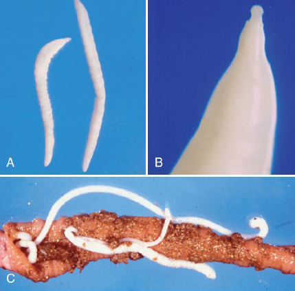 <p>How do hosts acquire <span style="color: blue;">Acanthocephalan </span>infection?</p>