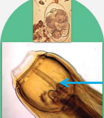 <p>-Common name: large strongyle, bloodworm, redworm</p><p>-Predilection: cecum</p><p>Characteristics:</p><p>-2 ear shaped teeth</p>