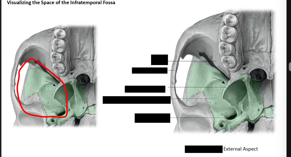 <p>Label the infratemporal fossa</p>