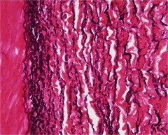 <p>a dense regular elastic tissue dominated by elastic fiber (ie. the tissue that stabilizes the position of the vertebrae)</p>