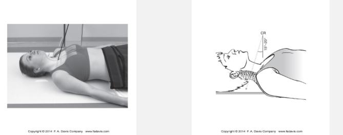 <p>What structures are visualized on an AP lower cervical spine radiograph?</p>