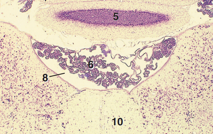 <p>Part and Stain?</p>