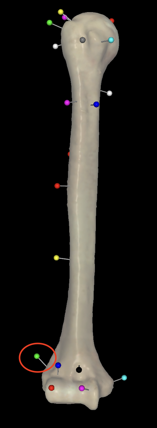 <p>What is the circled pin called on the right humerus?</p>