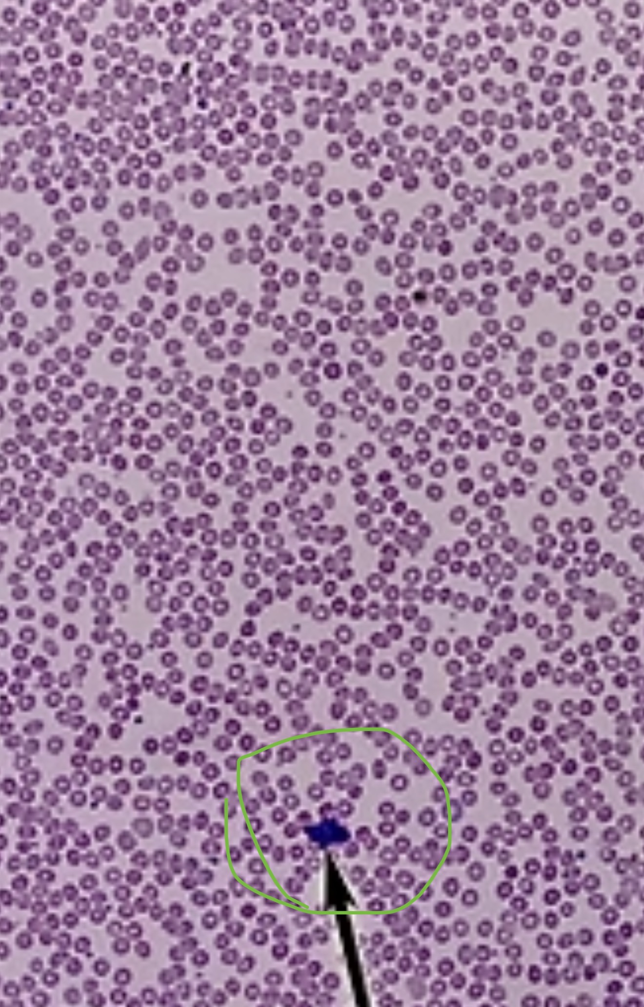 <p><span><span>white blood cells; colorless, nucleated blood cell which protects the body from disease. Contains granulocytes and agranulocytes</span></span></p>