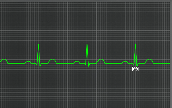 <p>what complex is this</p>