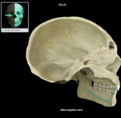 <p>What landmark of the mandible is this?</p>