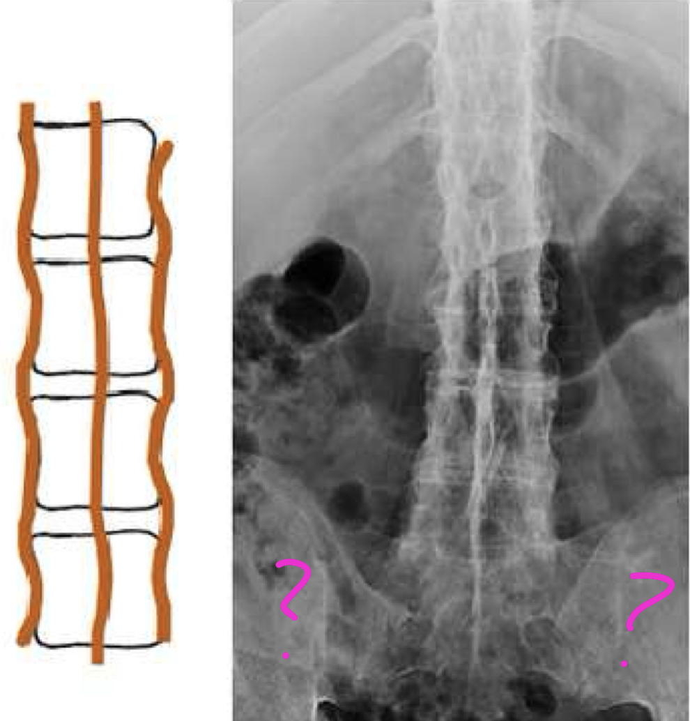 <p>Dagger sign + Railroad track sign =</p>