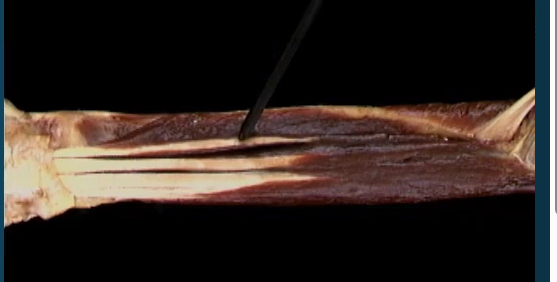 <p>Onder arm diep, anterior zicht</p>