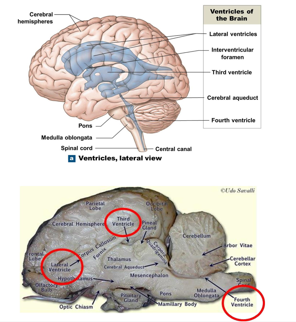 <p>Fourth ventricle</p>