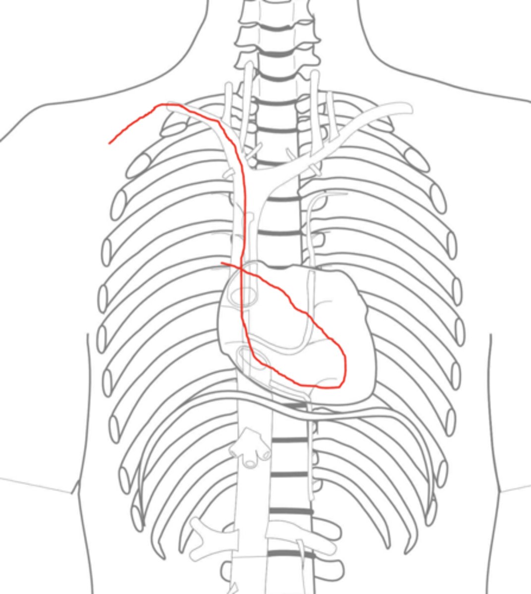 <p>only line to go into artery</p><p>multiple lumen line</p>