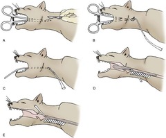 <p>LEFT side of neck --> 12-13th rib</p>