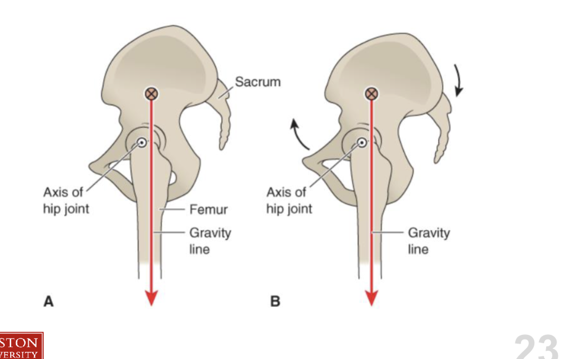 <p><strong>1) acetabulum = anteverted</strong></p><ul><li><p>less bony coverage of fem head in front, meaning strong ligaments needed to support front </p></li></ul><p></p><p><strong>2) femur = typical anteverted </strong></p><ul><li><p>more exposed femur than back of hip joint → less bone stability</p></li></ul><p></p><p><strong>3) Kinetics of hip joint </strong></p><ul><li><p>line of gravity is posterior to axis of hip joint → wanting pelvis to rotate CW direction (post tilt/extension of hip) </p></li><li><p>Ant ligaments give tension to have internal flexion forces </p></li></ul><p></p>