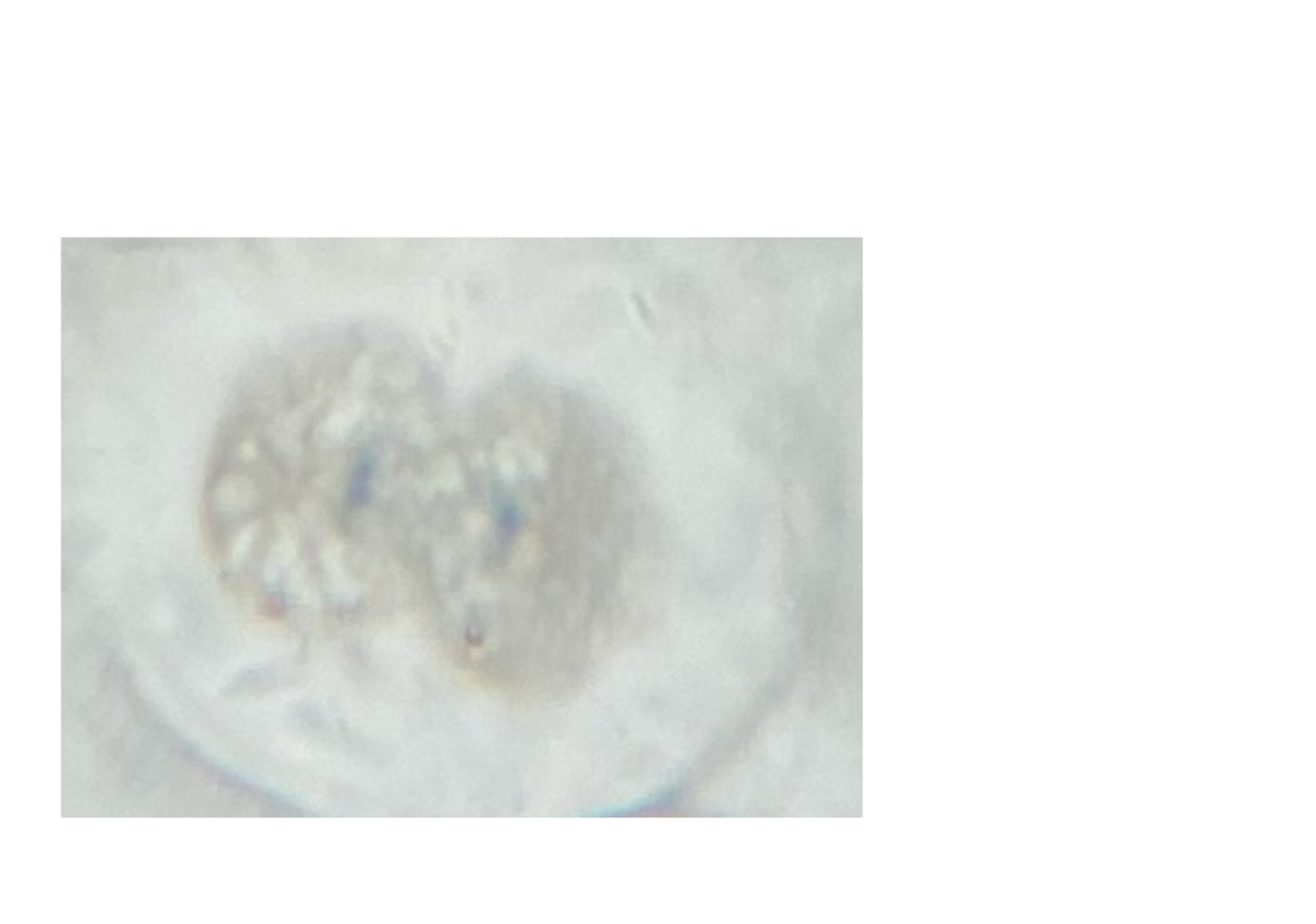 <p>What phase of mitosis is this?</p>