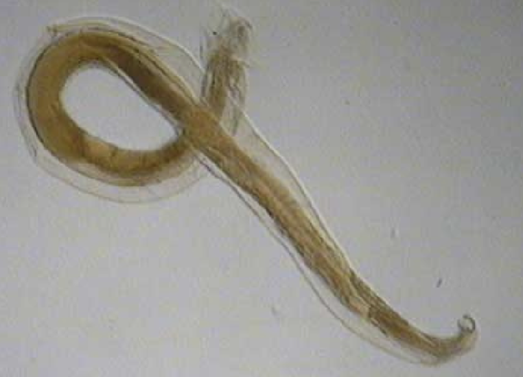 <p>What nematode/roundworm/parasitic worm is this?</p>