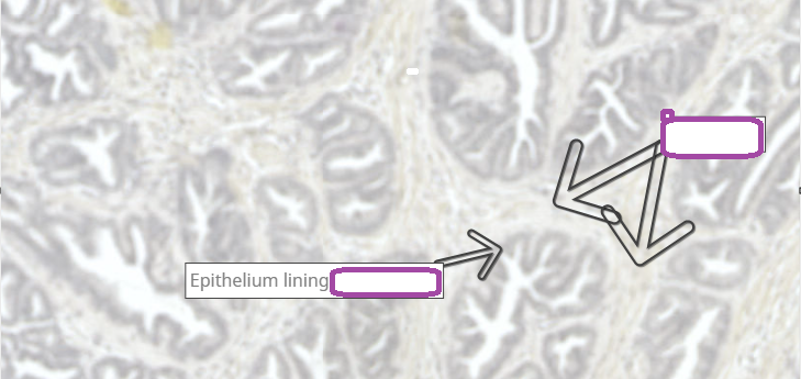 <p>prostate</p>