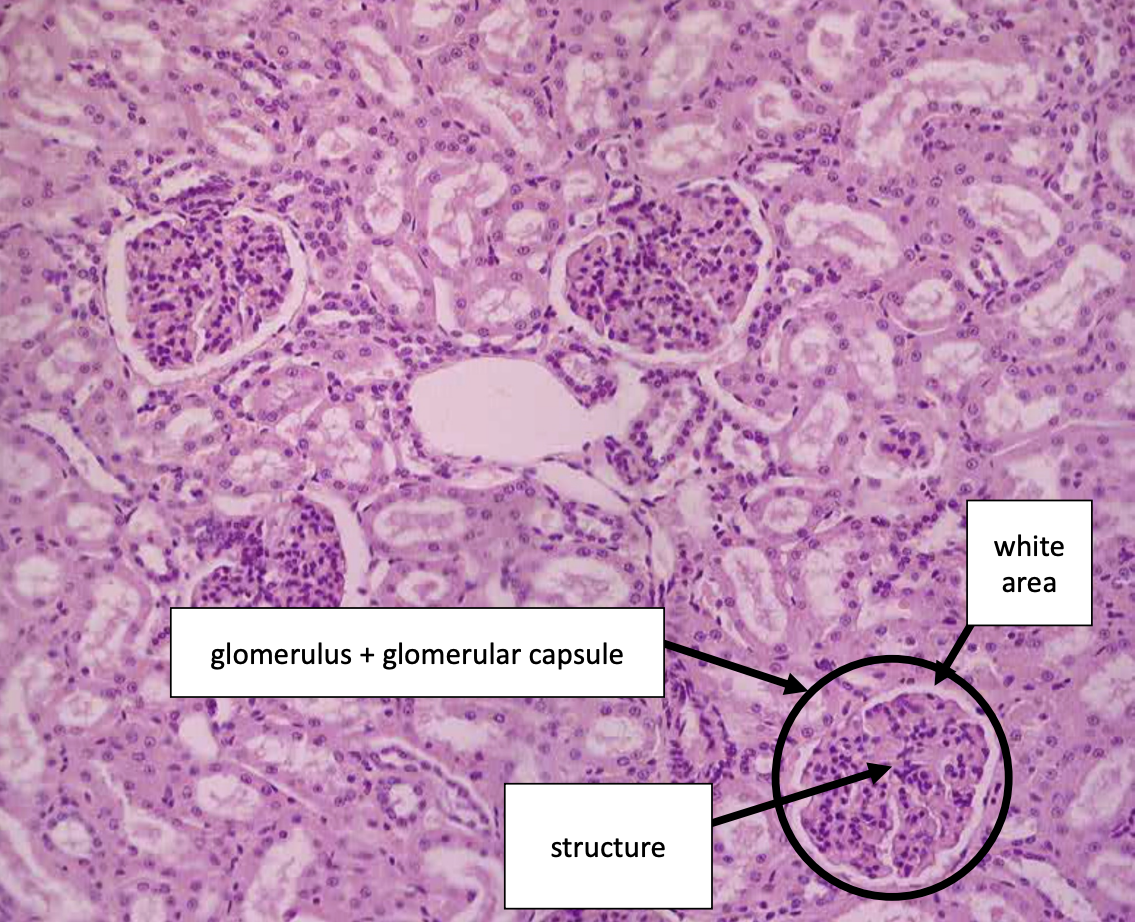 <p>what histology is this? </p>