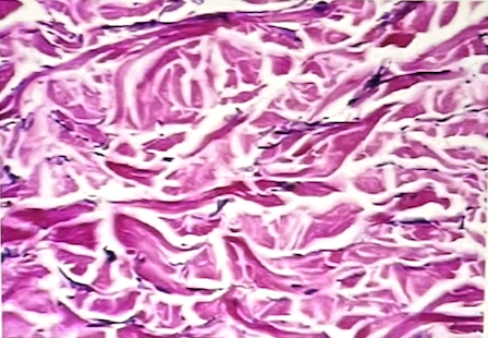 <p>Identify the specific connective tissue in the picture</p>