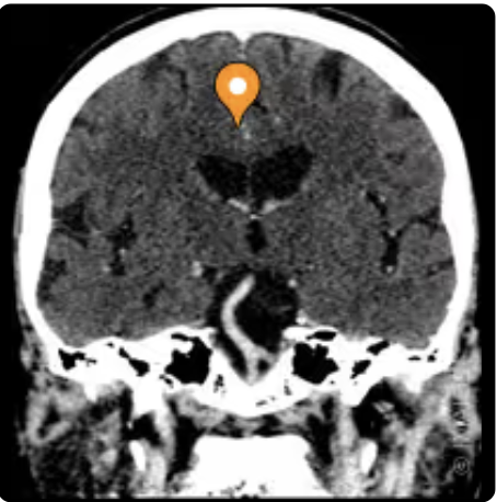 <p>Name the gyrus, modality, and the plane</p>
