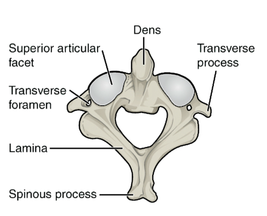 <p>What vertebrae is this?</p>