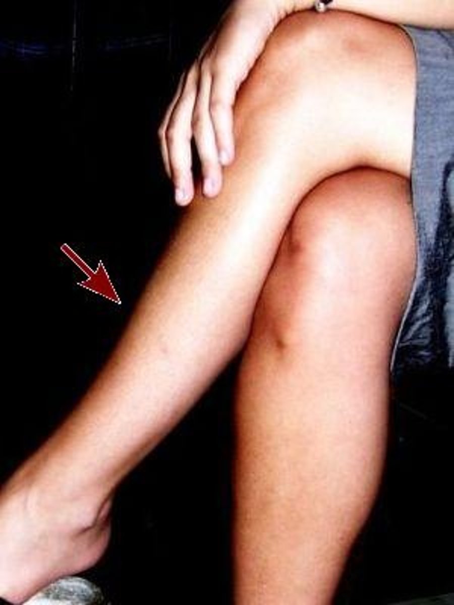 <p>the front of the leg below the knee</p>