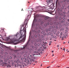 <p>Where would you find hemidesmosomes?</p>