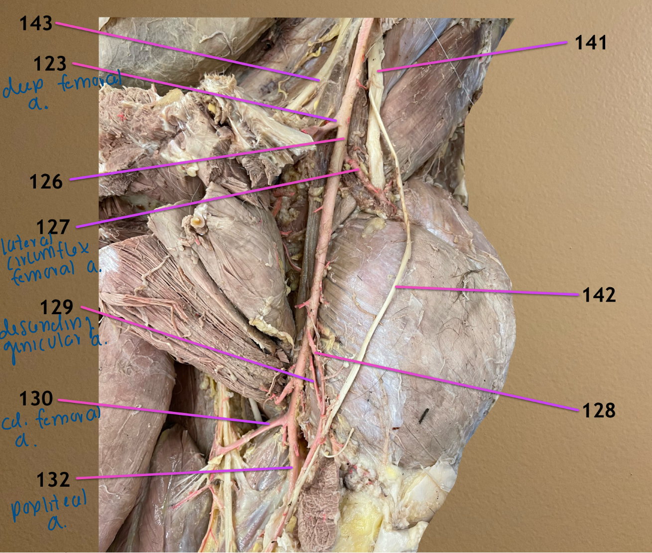 <p>medial view of blood flow near inguinal canal</p><p>.</p><p>label 141-143</p>