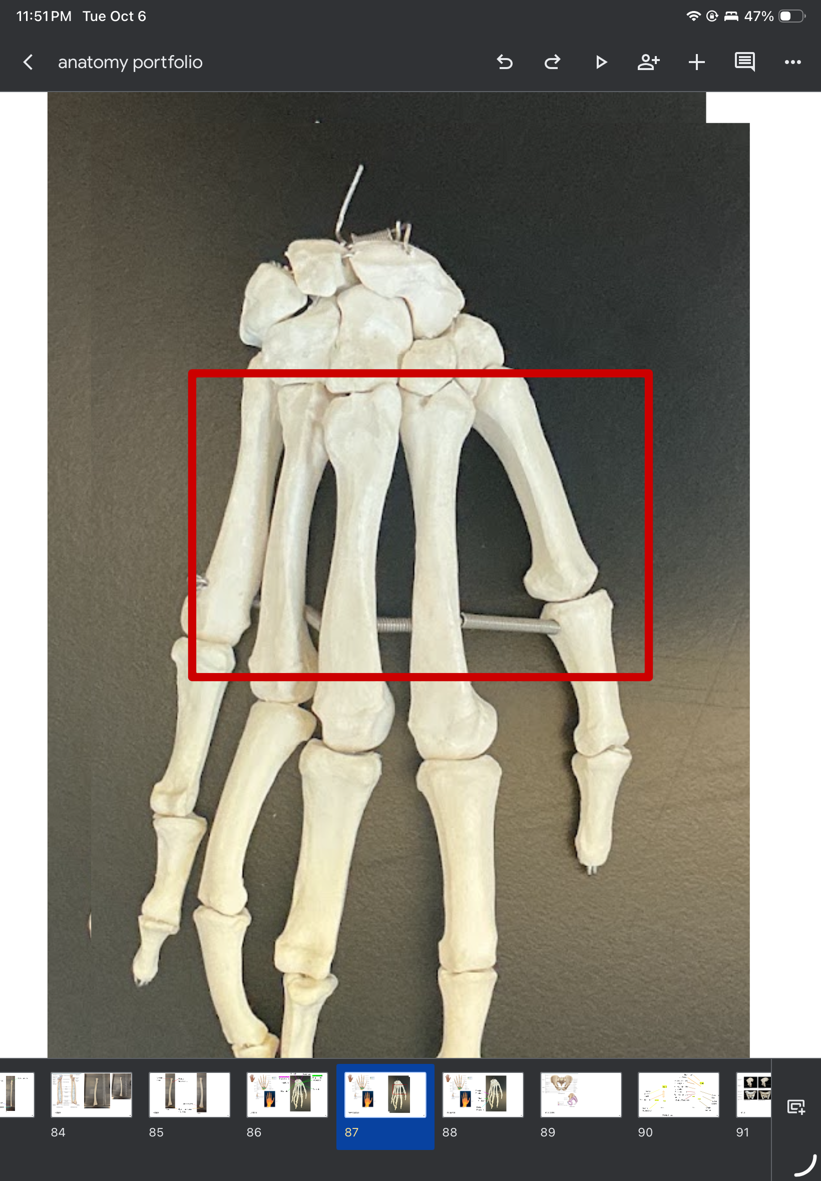 <p>What are these?</p>