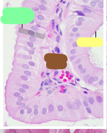 <p>Identify this structure </p>
