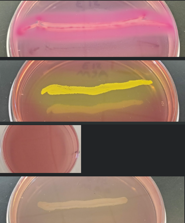 <p><span>You have a patient with a boil on their skin. &nbsp;You suspect </span><em>Staphylococcus aureus.</em><span>&nbsp; </span><em>S. aureus </em><span>is a Gram-positive cocci that ferments mannitol. It is capable of beta-hemolysis.&nbsp; It is a halophile.&nbsp; It does not ferment lactose.&nbsp; What would you observe if you plated this sample on a MSA plate?</span></p>