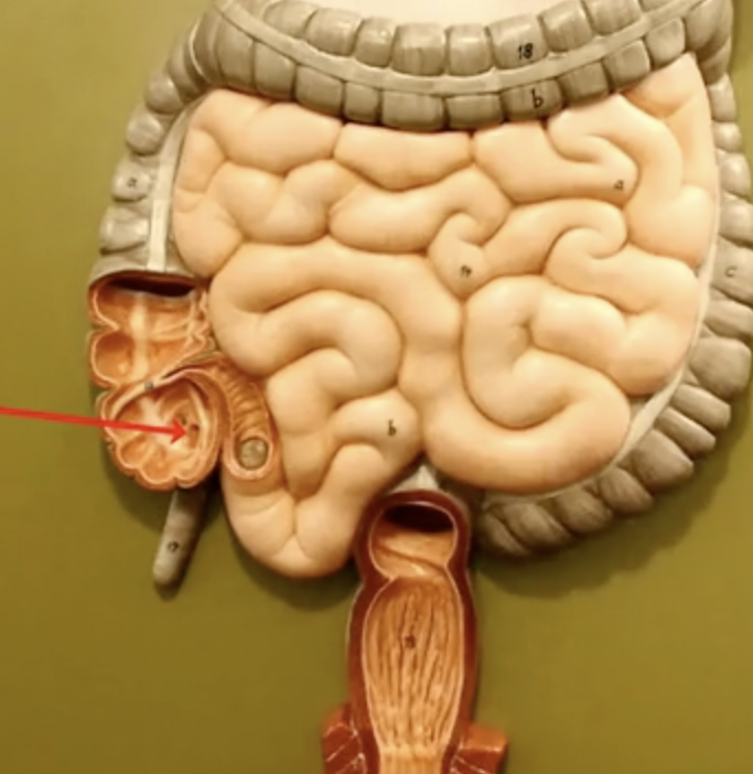 <p>What is the arrow pointing to?</p>