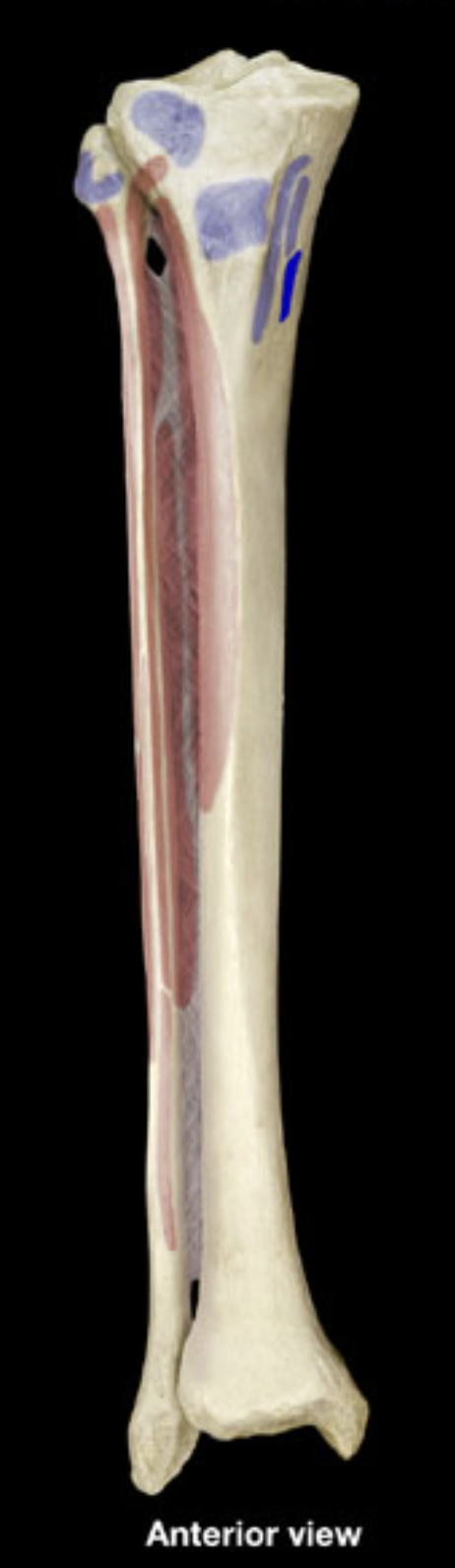 <p>proximal shaft of tibia</p>