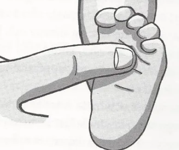 <ul><li><p>primitive reflex - spinal cord</p></li><li><p>place finger at base of toes => toes curl around finger</p></li><li><p>integrates at 9 months (just before walking)</p></li></ul><p></p>
