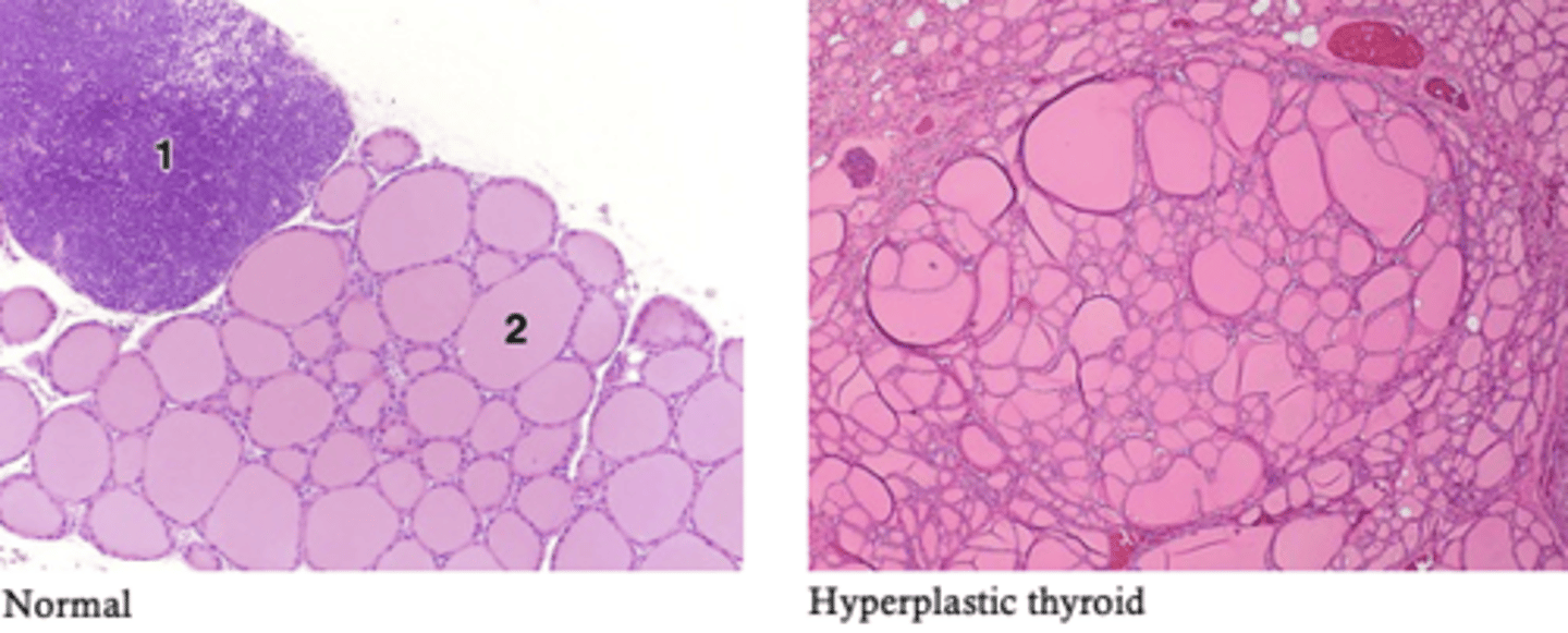 <p>increase in number of cells</p>