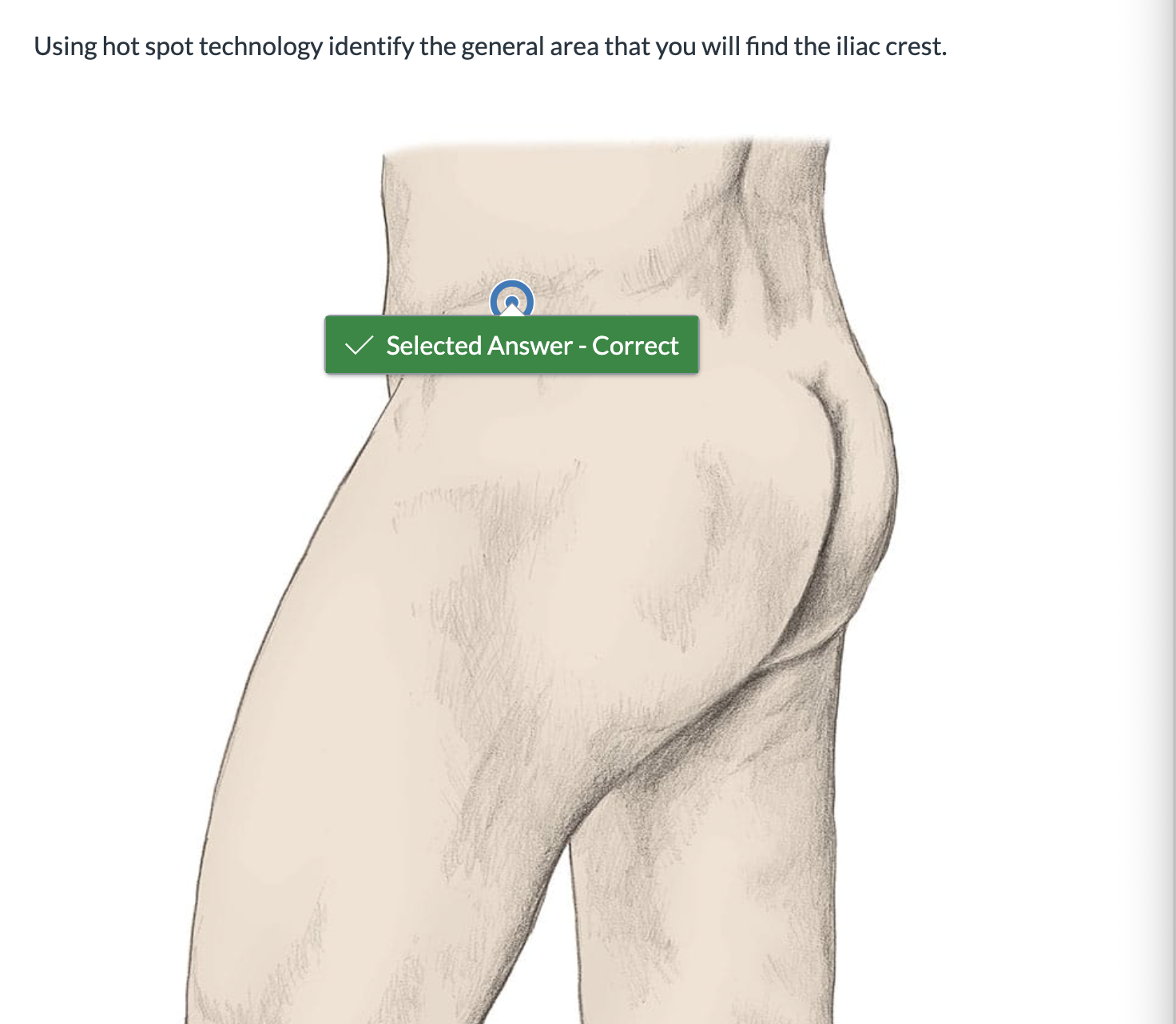 <p><span>Using hot spot technology identify the general area that you will find the iliac crest.</span></p>