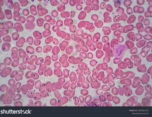 <p>Which kind of tissue is shown?</p>