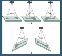 <ul><li><p>Radiographic misrepresentation of either the size or shape of the anatomic part is called distortion.</p></li><li><p>2 types </p><ul><li><p>Size</p></li><li><p>Shape</p></li></ul></li></ul><p><span>When angling the beam, shape distortion will occur on the image,</span></p>