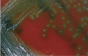 <p>34. What enzyme is needed to produce clearing or greening?</p>