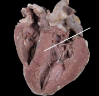 <p><span style="line-height: 17.375px;">Identify the structure</span></p>