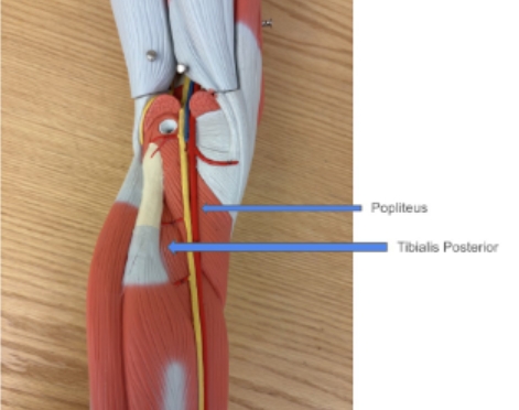 <p><span style="background-color: transparent; font-family: "Times New Roman", serif;">Popliteus, Tibialis Posterior</span></p>