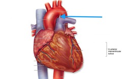 <p>identify the structure</p>
