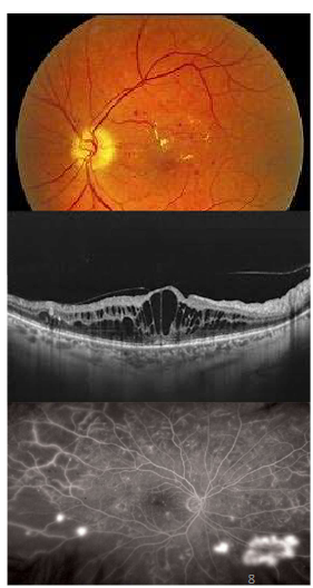 <p>Name this condition</p>